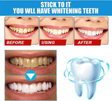 Teeth Whitening Essence,Teeth Whitening Essence Pen,Fast and Effective Removal Tooth Stain Removal,for Sensitive Teeth